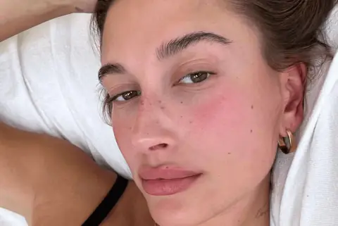 5 DIY Techniques for Creating Natural-Looking Freckles